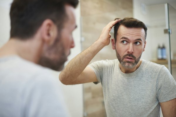 Conseils perte de cheveux homme : solutions efficaces et naturelles